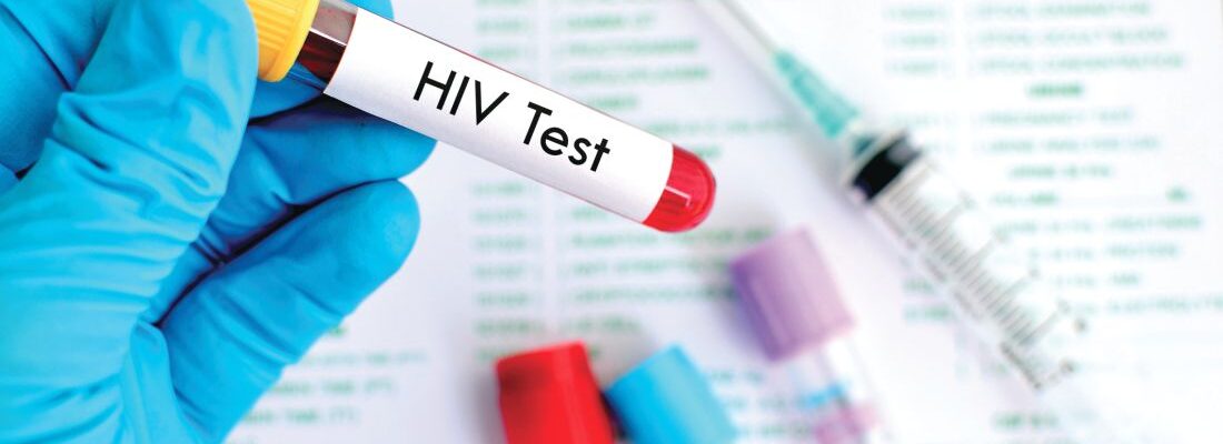 Can HIV Be Detected Through a Urine or Blood Test?