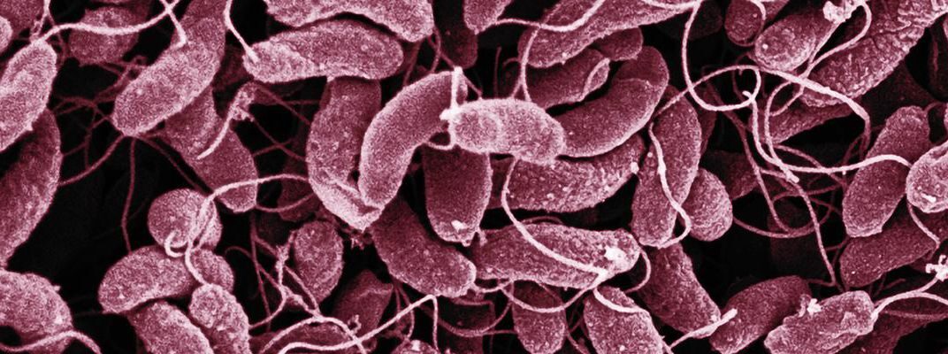 How to Determine if You Have Cholera