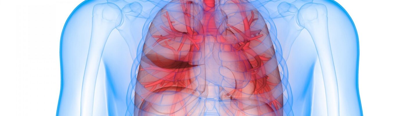 Pneumonia