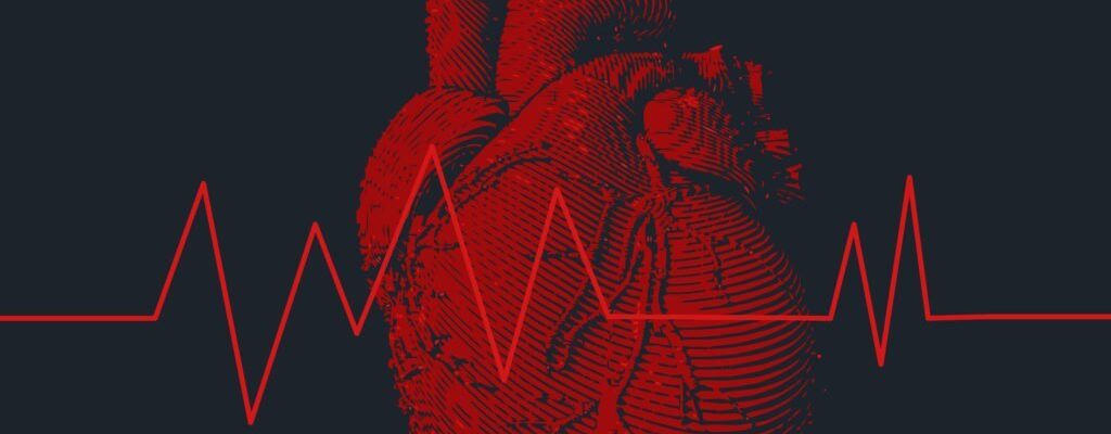 Arrhythmia