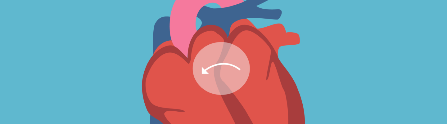Congenital Heart Disease