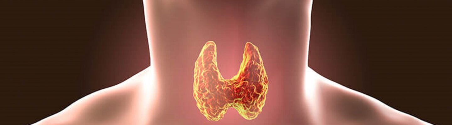 Hypothyroidism
