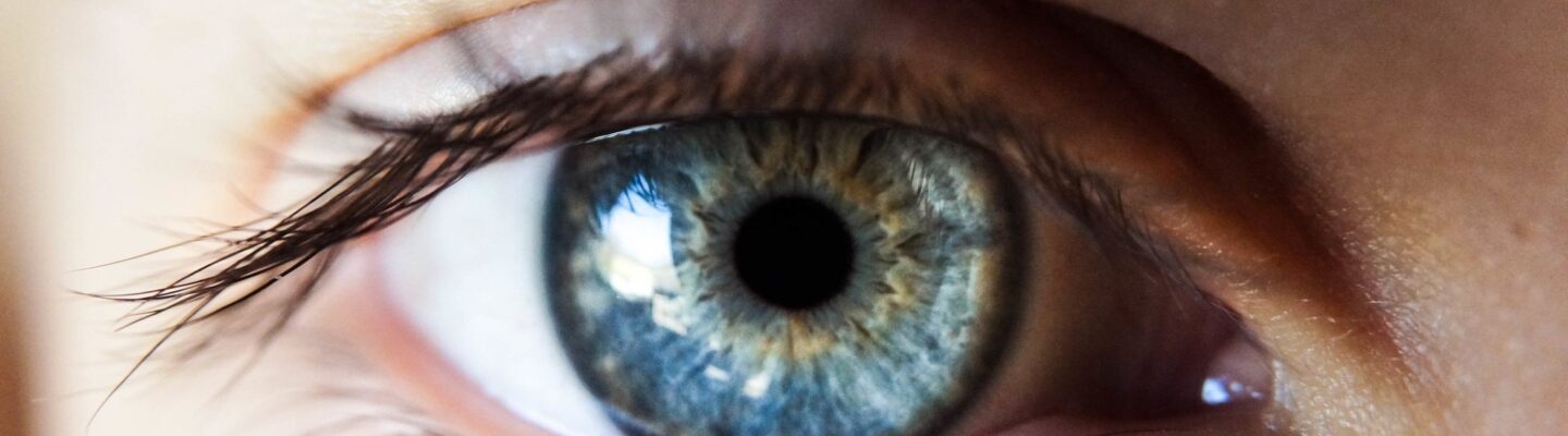Myopia (Nearsightedness)