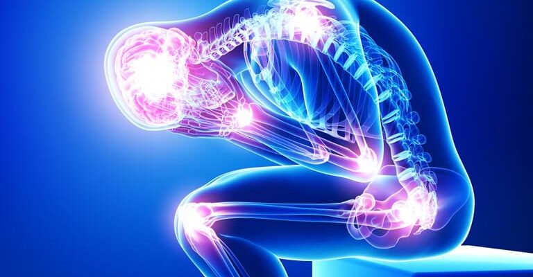 Fibromyalgia