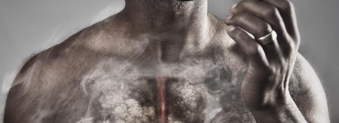 Emphysema