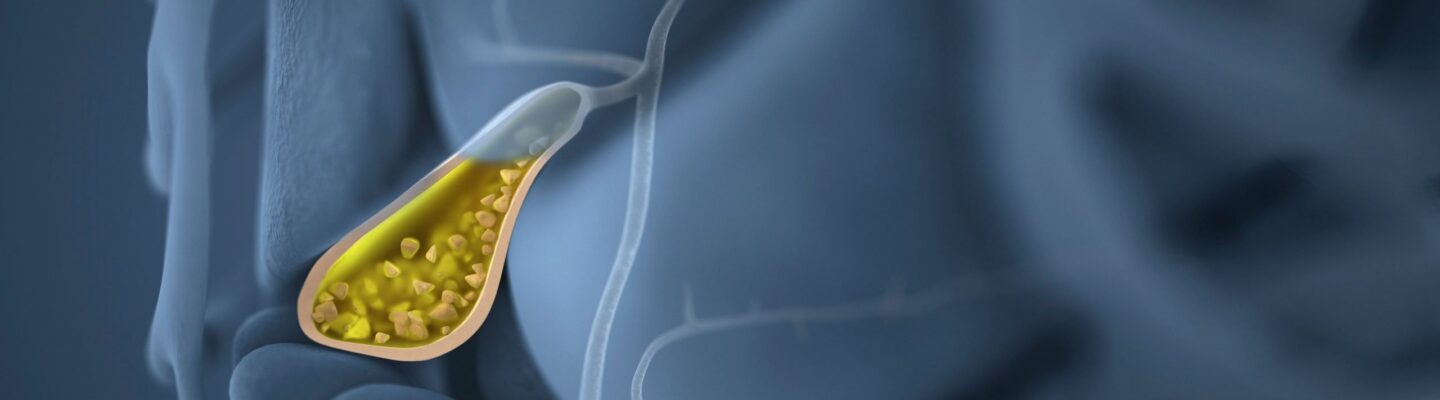 Gallbladder Polyps