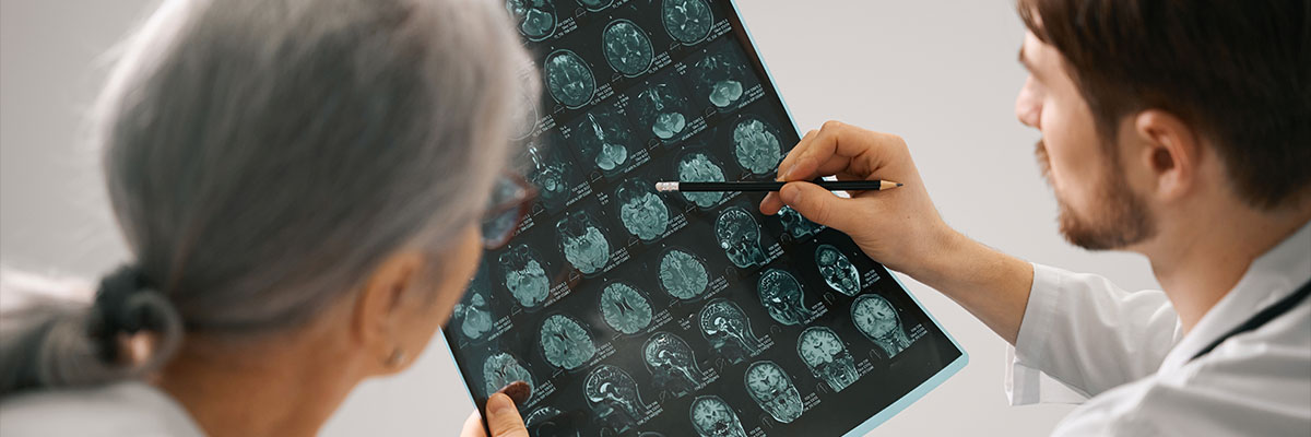 Alzheimer’s Disease