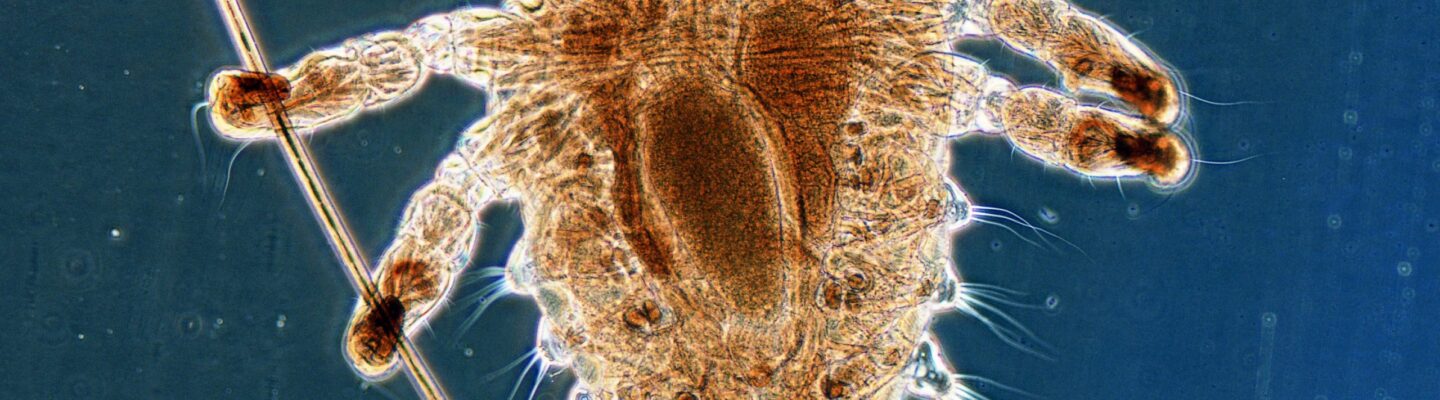 Pubic Lice