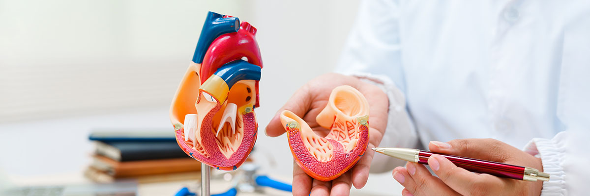 Dilated Cardiomyopathy