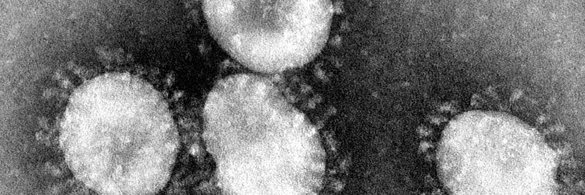 Severe Acute Respiratory Syndrome (SARS)