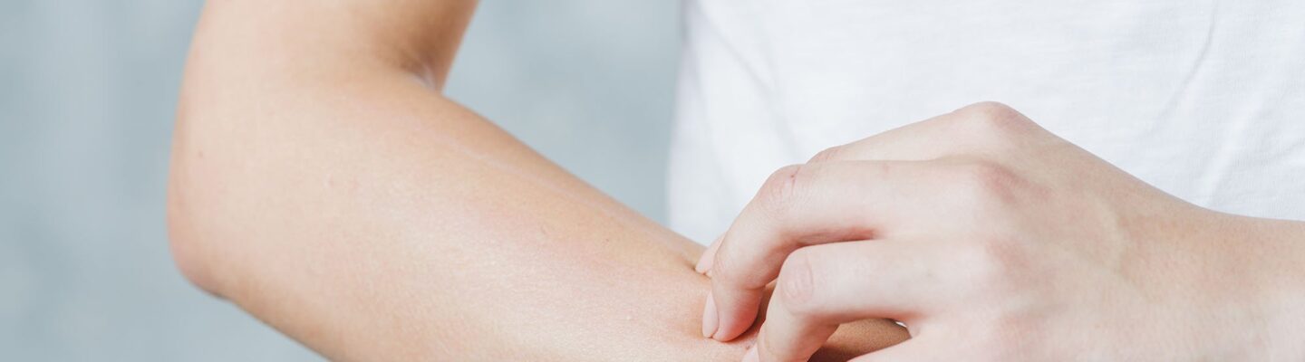 Common Skin Diseases Experienced by Filipinos