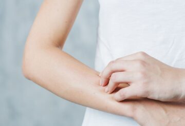 woman scratching hand