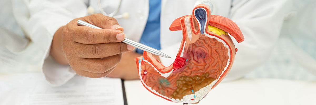 Stomach Cancer