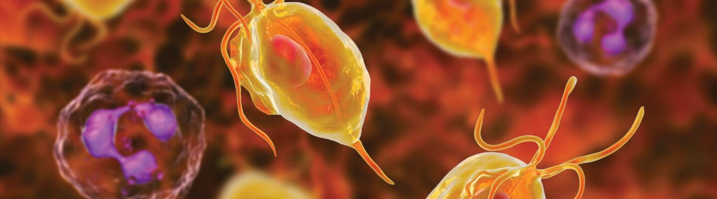 Trichomoniasis