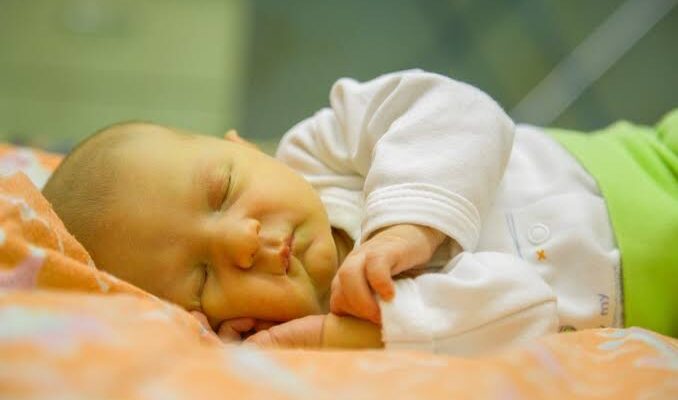 Infant Jaundice