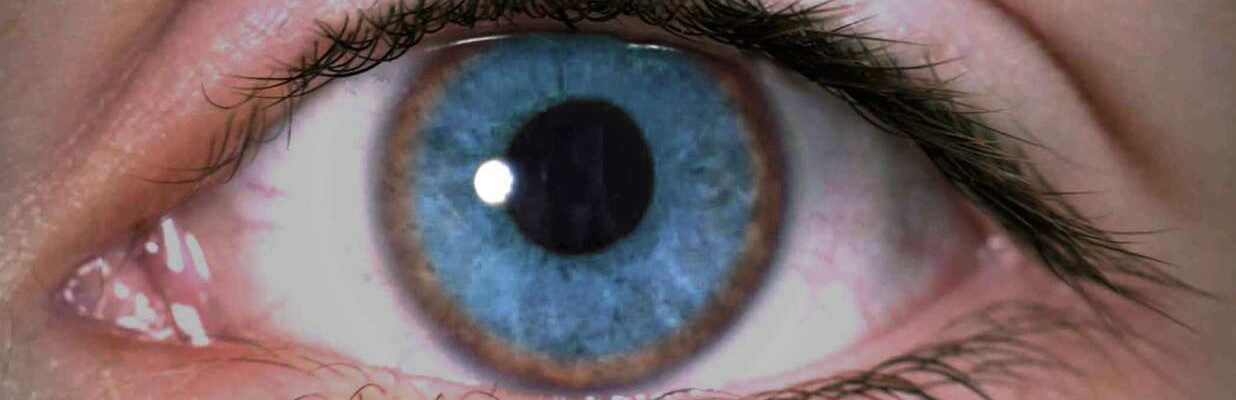 Wilson’s Disease