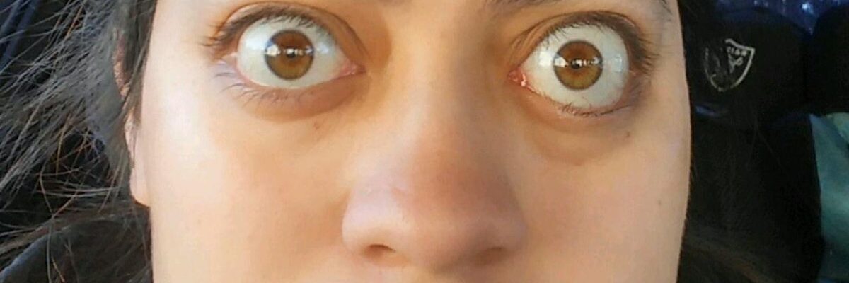 Graves’ Disease
