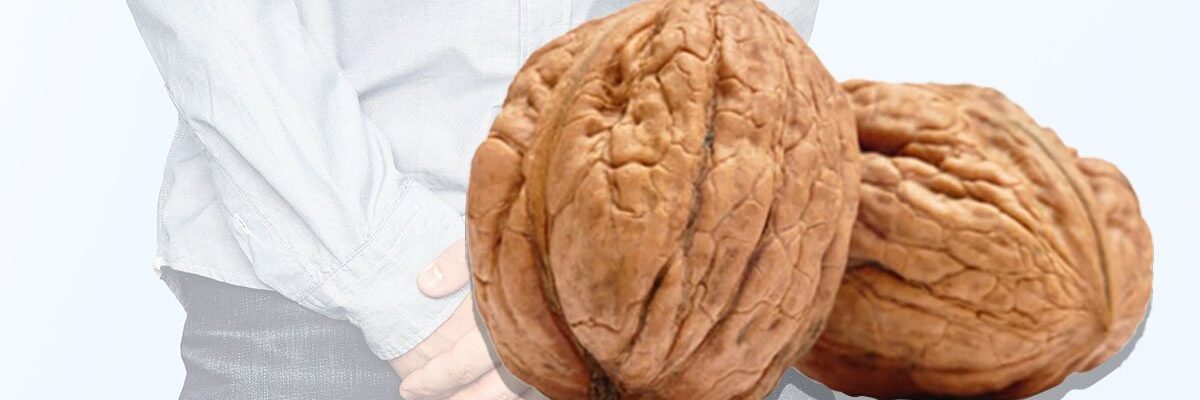 Testicular Cancer