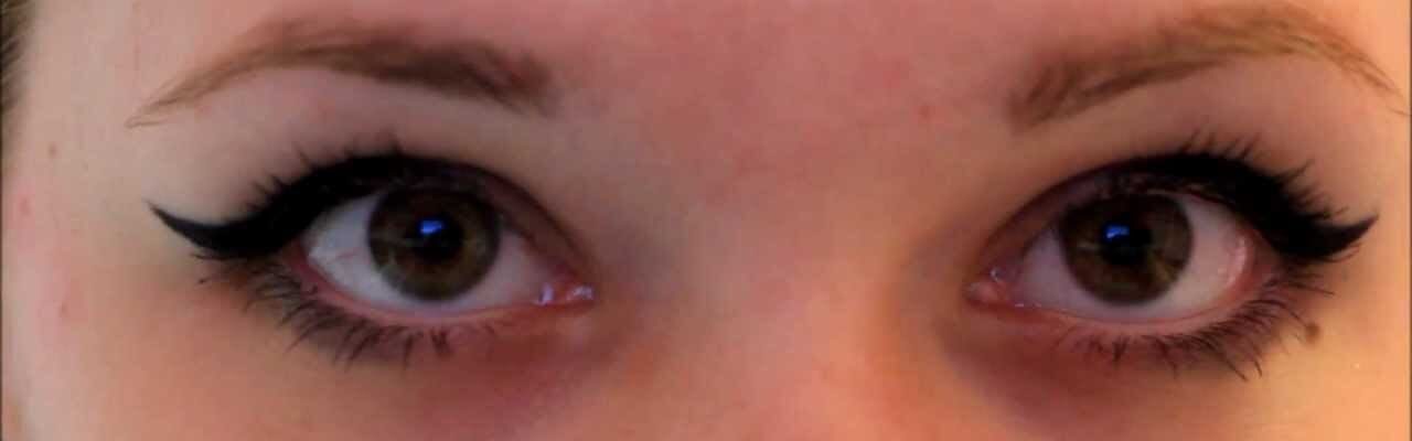 Nystagmus