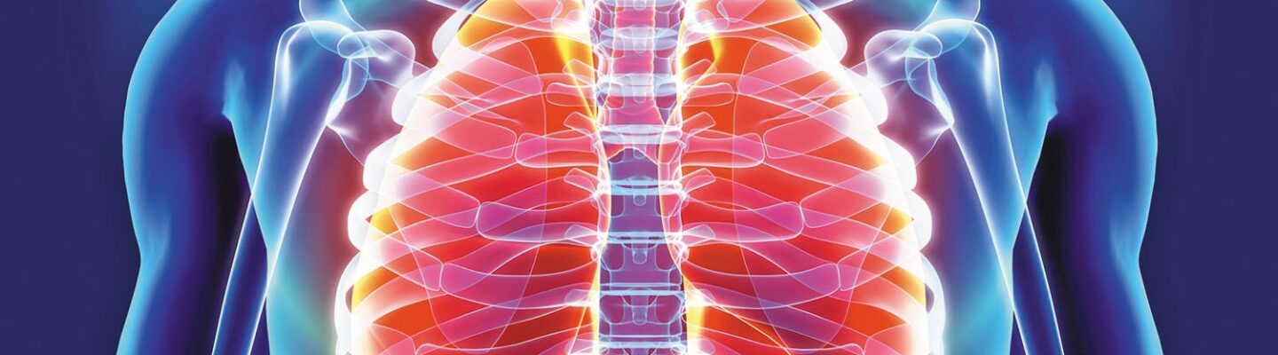 Acute Bronchitis