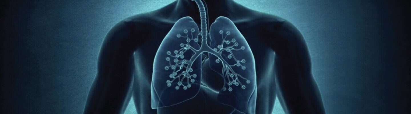 Chronic Bronchitis