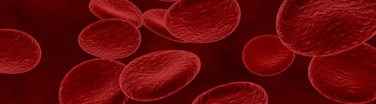 Sepsis (Septicemia)