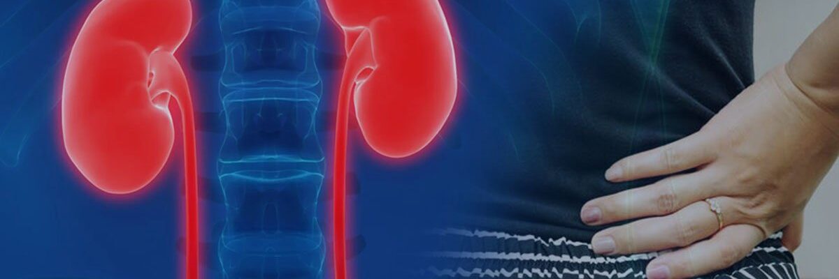Kidney Infection