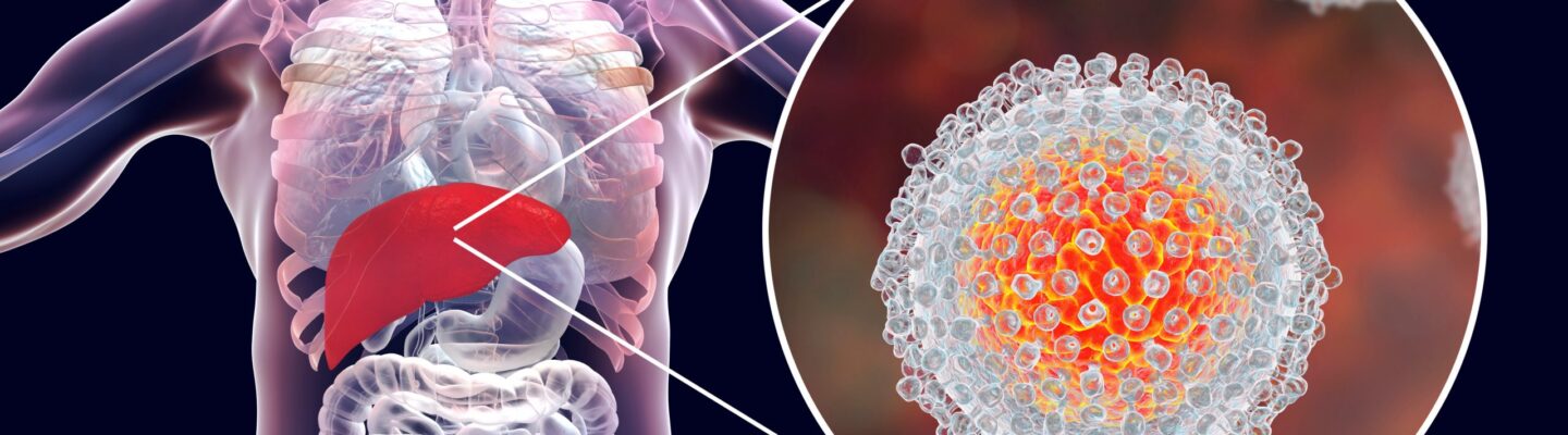 Hepatitis