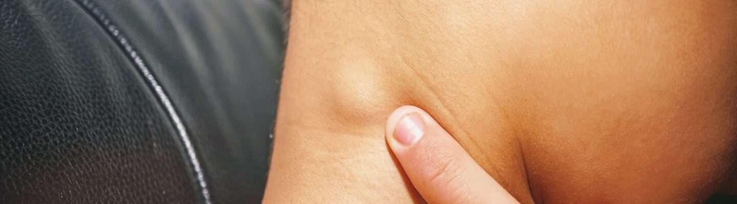 What Are Lymph Nodes