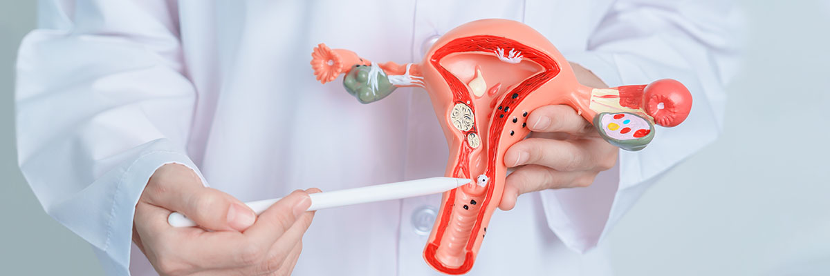 Uterine Cancer (Endometrial Cancer)