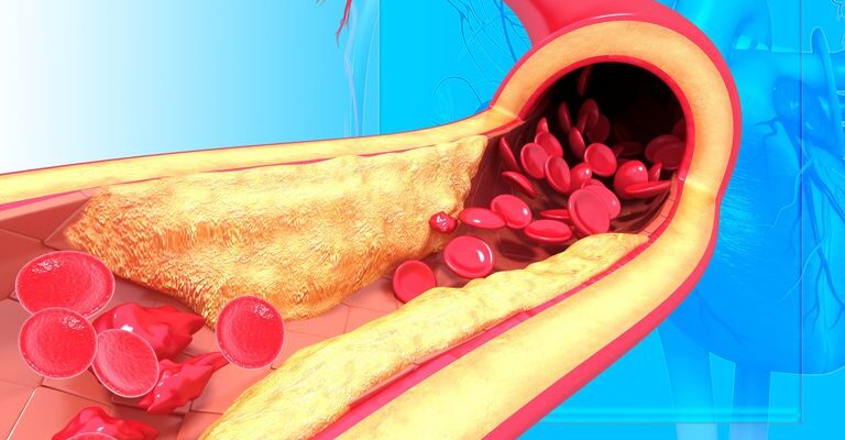 Good and Bad Cholesterol: What’s the Difference?