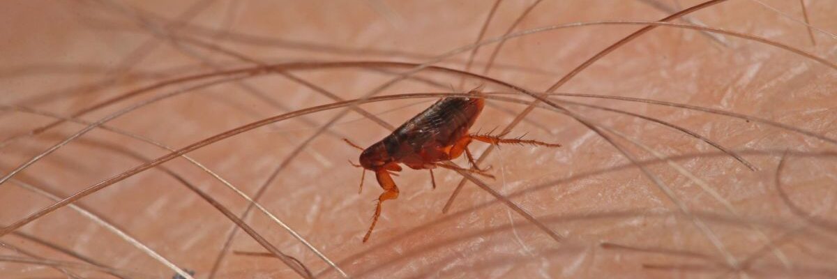 Typhus Fever