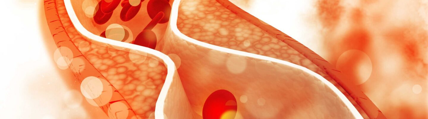 8 Foods That Help Lower Cholesterol