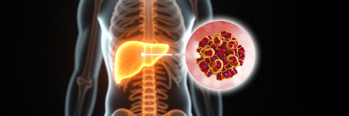 Hepatitis E