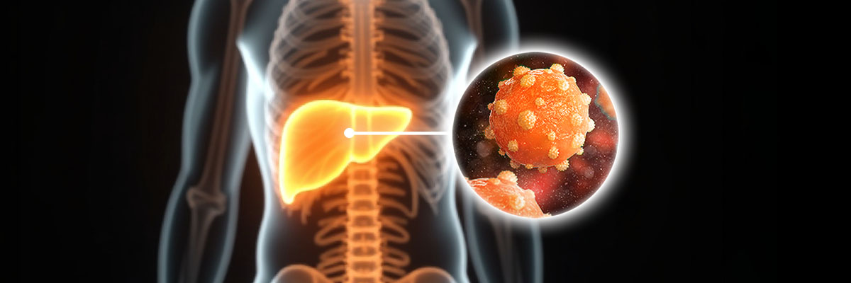 Hepatitis C