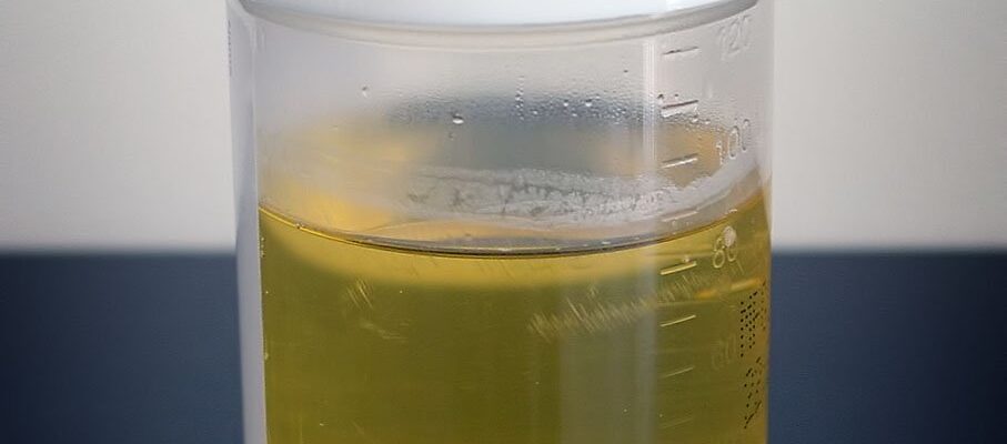 Is Drinking Urine a Healthy Habit?