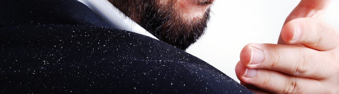 What Are the Symptoms of Dandruff