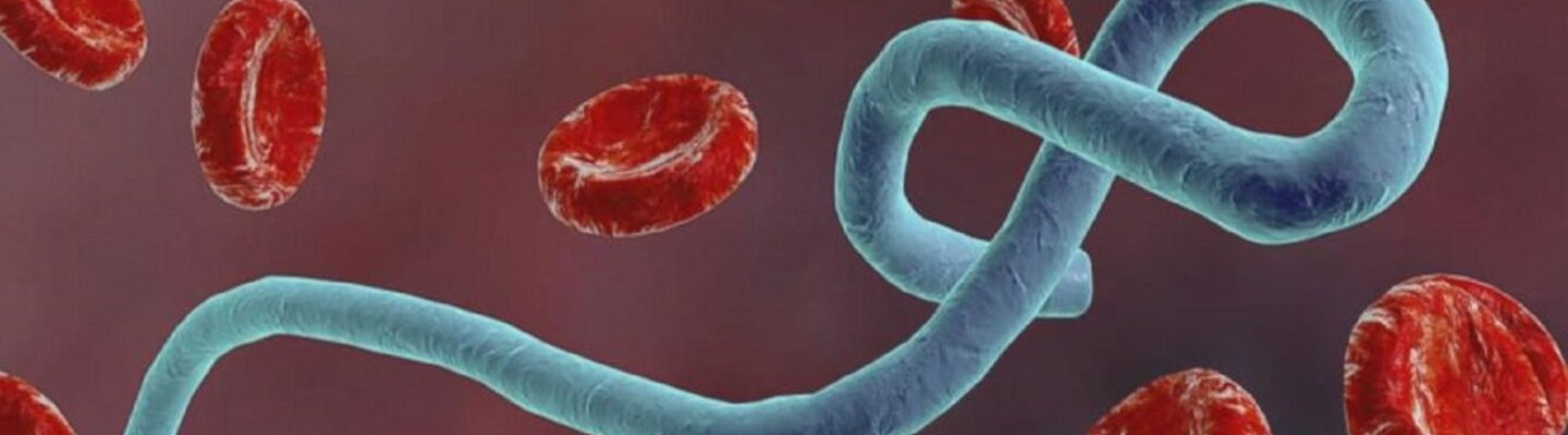 How to Prevent Ebola