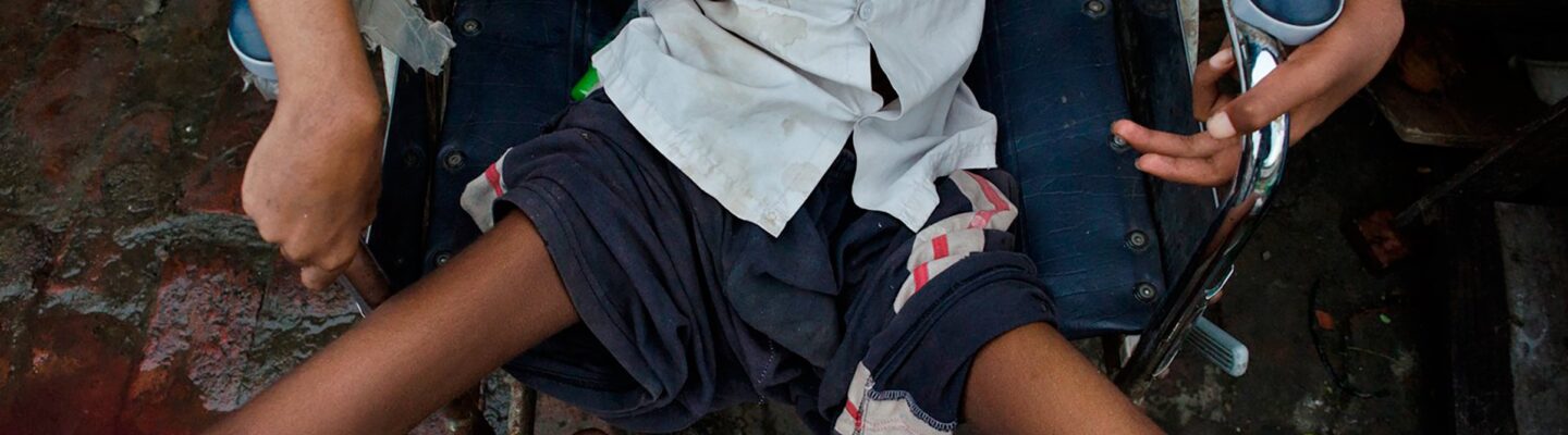 Polio Remedies and Care