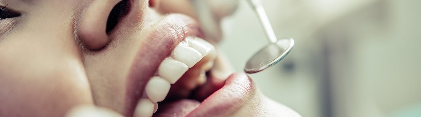 Tooth Decay