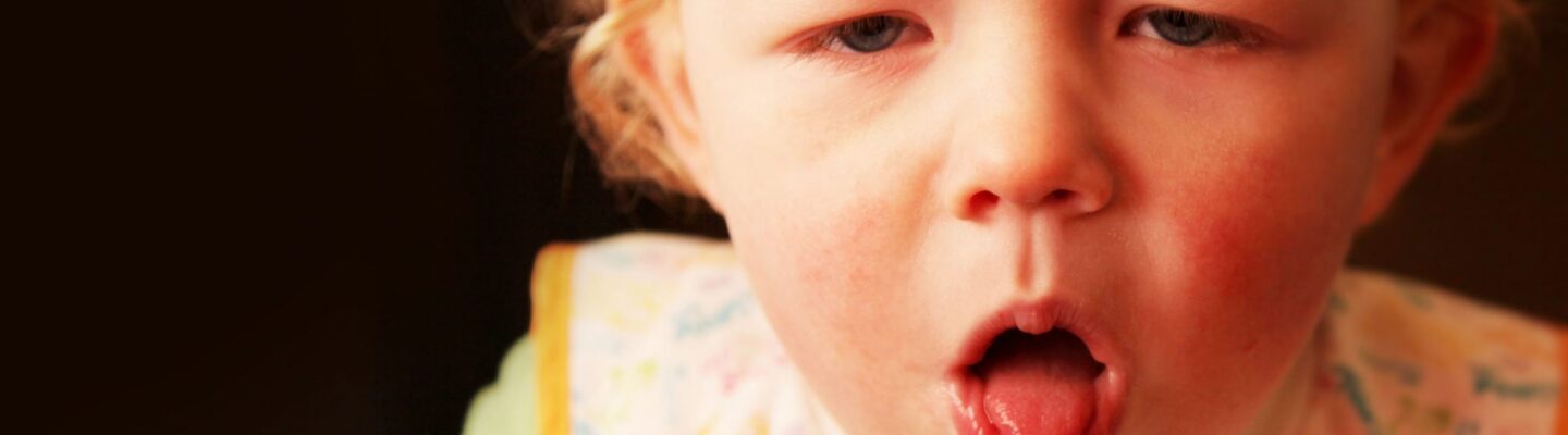 Pertussis