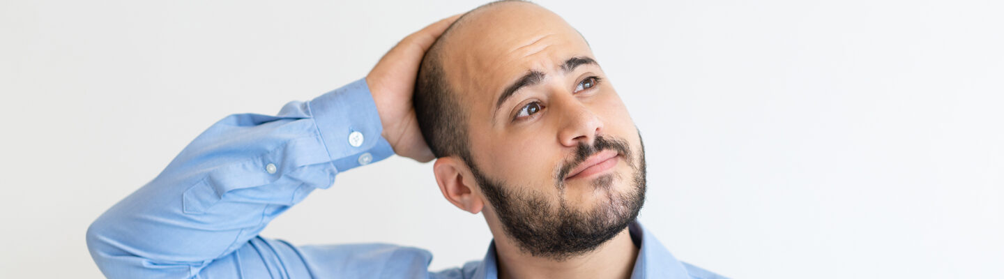 Alopecia
