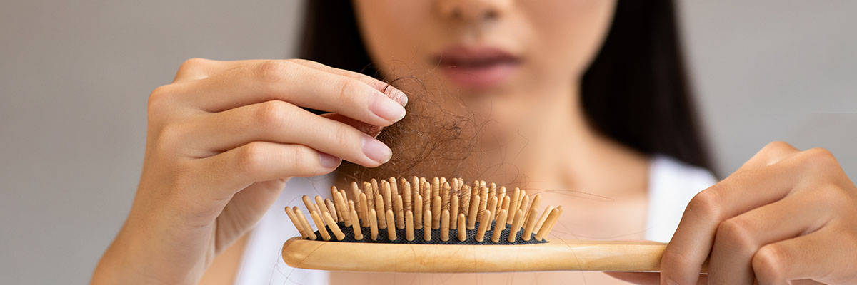 Hair Loss in Women