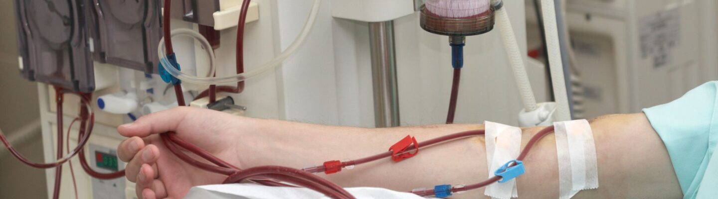 Dialysis