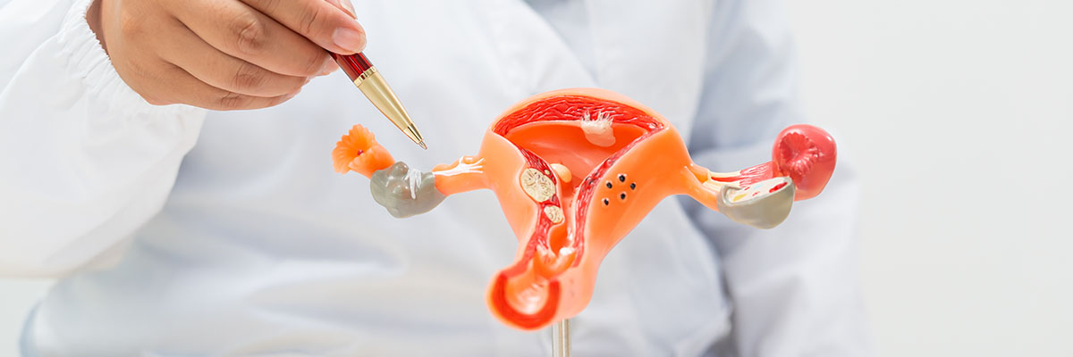 Tubal Ligation (Bilateral Tubal Ligation)
