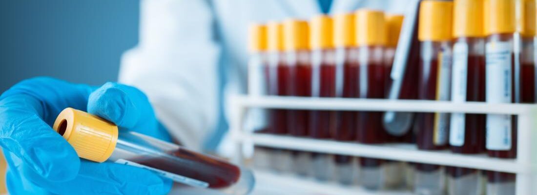 Blood Chemistry Test