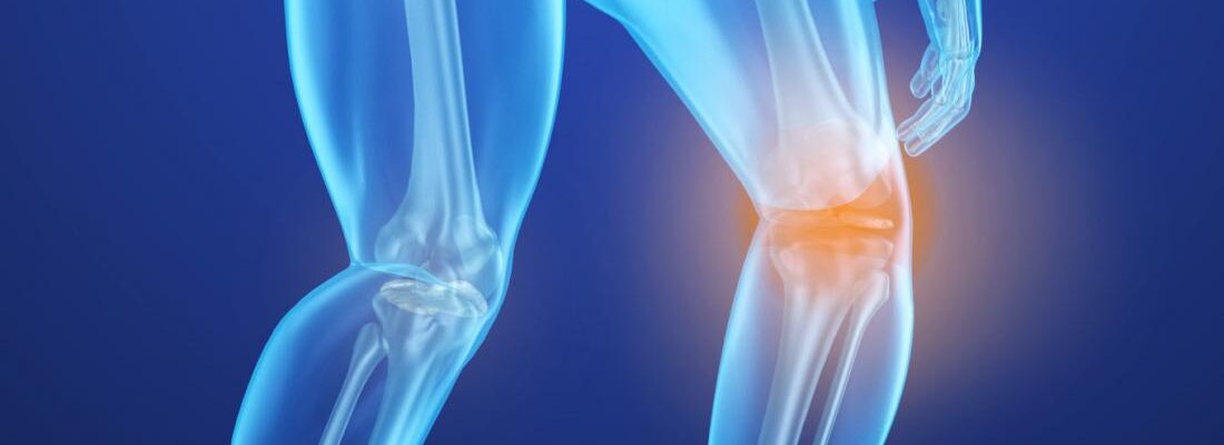 Knee Pain